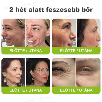 ⏰Rolimey® Botox & Vita-A Retinol Shot ráncfeszesítő krém ⏰ Utolsó nap! 70% kedvezmény