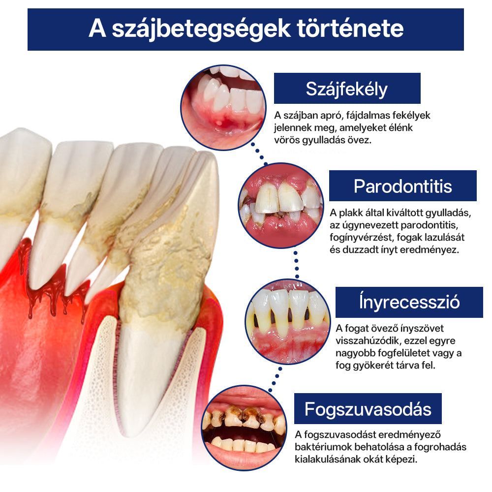 ✅Rolimey® BeeTakt Méhméreg Fogápoló Cseppek Szájvíz-📦