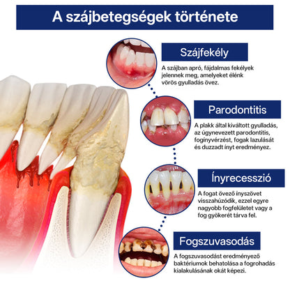 ✅Rolimey® BeeTakt Méhméreg Fogápoló Cseppek Szájvíz-📦