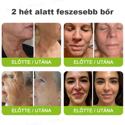 ⏰Rolimey® Botox & Vita-A Retinol Shot ráncfeszesítő krém ⏰ Utolsó nap! 70% kedvezmény