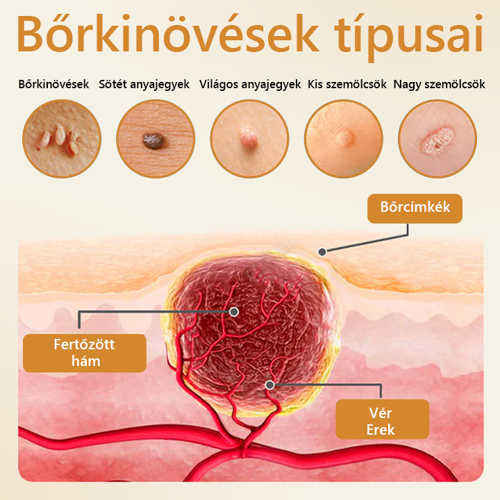 Pureluxo® BeeVenom Szemölcs Megújító Spray 🇭🇺