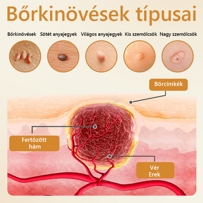 Pureluxo® BeeVenom Szemölcs Megújító Spray 🇭🇺