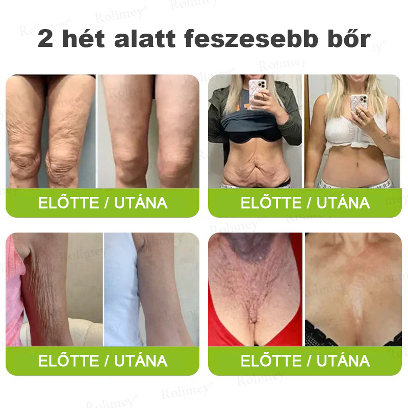⏰Rolimey® Botox & Vita-A Retinol Shot ráncfeszesítő krém ⏰ Utolsó nap! 70% kedvezmény