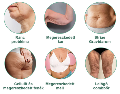 🏆3 egymást követő év Readers’ Choice díjnyertes Moondar™ feszesítő krém – visszaadja a bőr rugalmasságát és fiatalos ragyogását