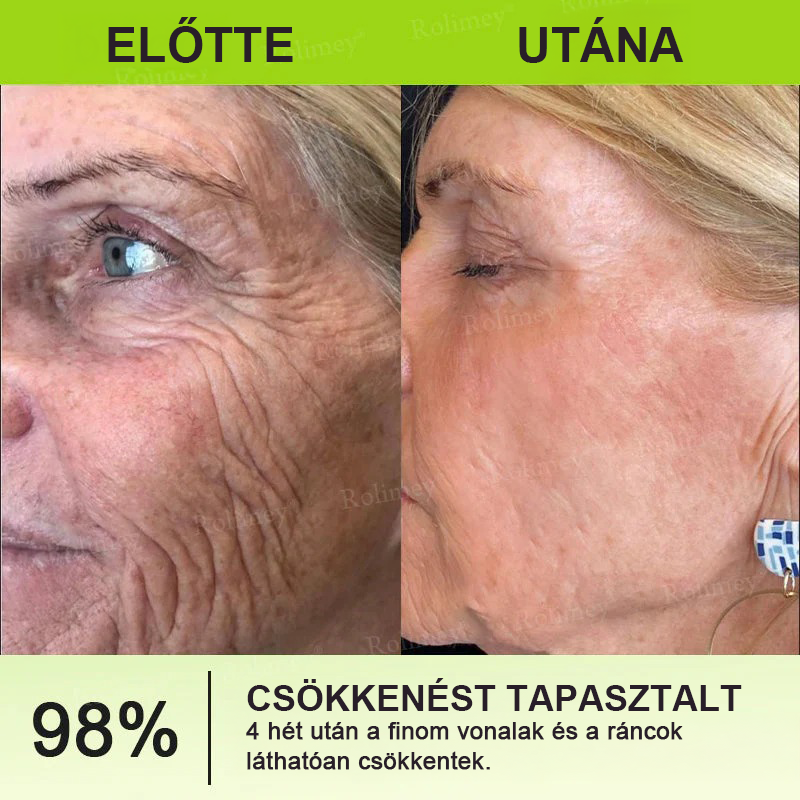 ⏰Rolimey® Botox & Vita-A Retinol Shot ráncfeszesítő krém ⏰ Utolsó nap! 70% kedvezmény