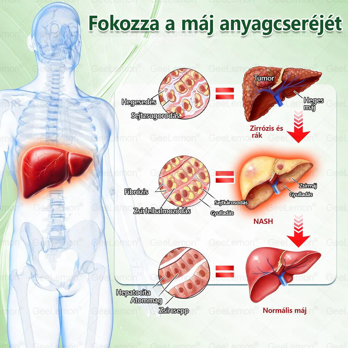 Ajánlott a Semmelweis Kórház által · BENU hivatalos üzlet| 👩‍⚕️ 𝐆𝐞𝑒𝐿𝑒𝐦𝐨𝐧® Glumasetide 8 az 1-ben Karcsú és Egészséges Nano Mikrotűs Tapasz