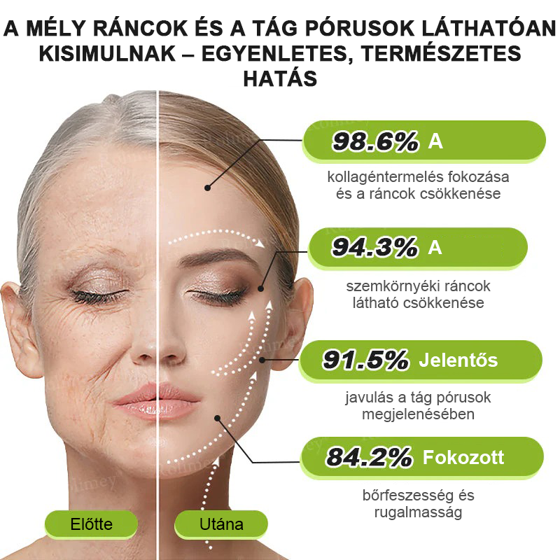 ⏰Rolimey® Botox & Vita-A Retinol Shot ráncfeszesítő krém ⏰ Utolsó nap! 70% kedvezmény