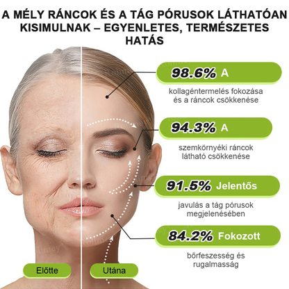 ⏰Rolimey® Botox & Vita-A Retinol Shot ráncfeszesítő krém ⏰ Utolsó nap! 70% kedvezmény