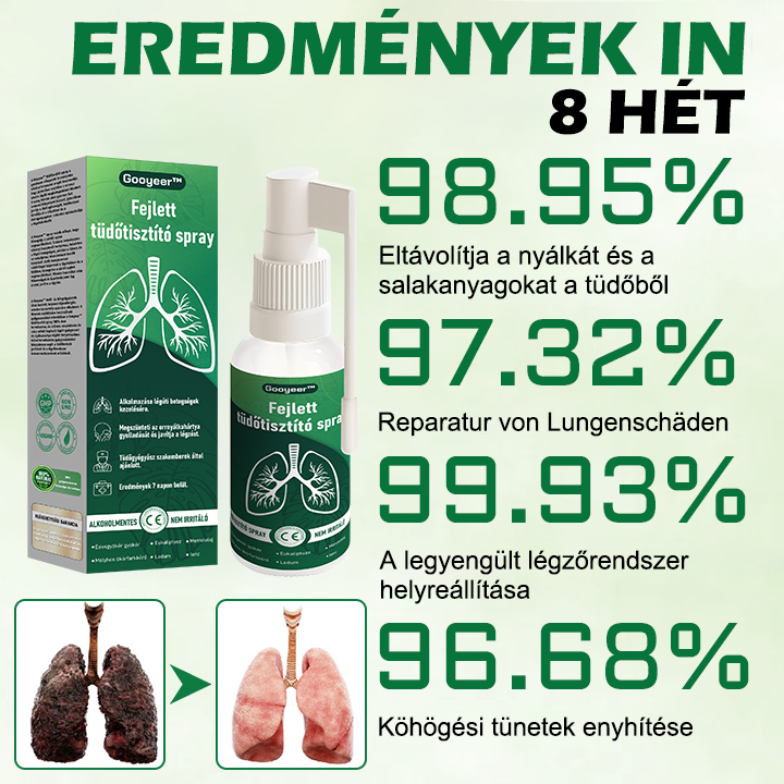 🌿𝐆𝐨𝐨𝐲𝐞𝐞𝐫™ Fejlett Tüdőtisztító Spray -Támogatja a tüdő, a hörgők és az orrmelléküregek egészségét, elősegíti a légzőrendszer egészségét és a könnyebb légzést