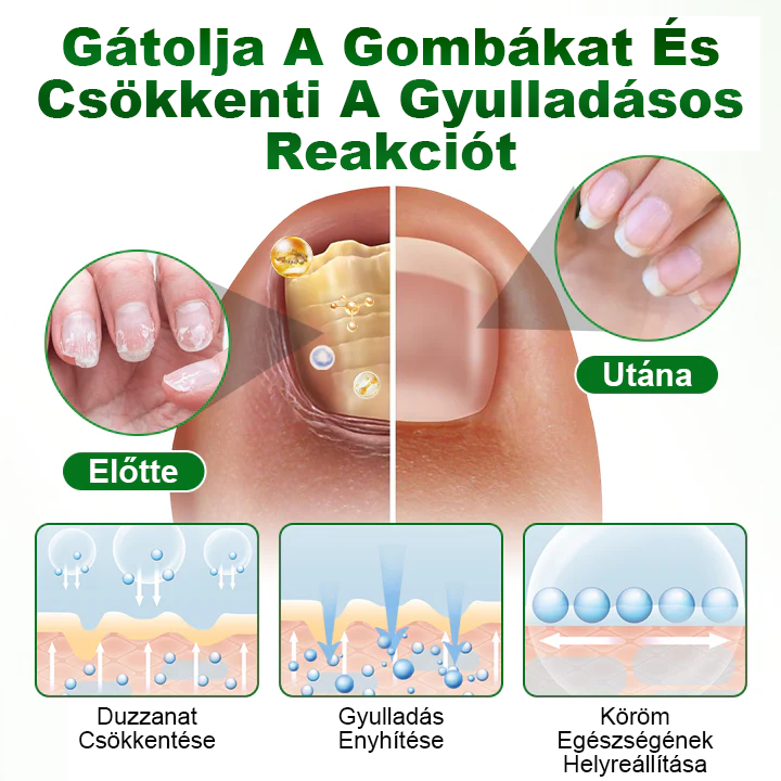 Pureluxo® HerbaNail 7 napos körömjavító szérum✨