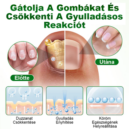 Pureluxo® HerbaNail 7 napos körömjavító szérum✨