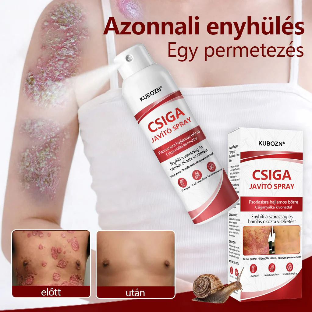 💡KUBOZN®  csigahéjas spray viszkető, hámló pikkelysömörös bőrre