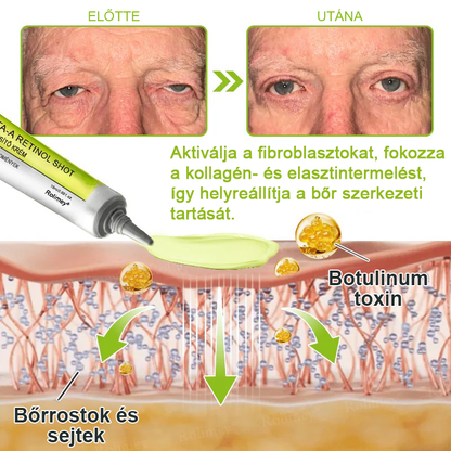 ⏰Rolimey® Botox & Vita-A Retinol Shot ráncfeszesítő krém ⏰ Utolsó nap! 70% kedvezmény