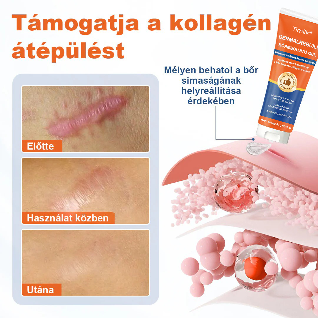 🔥Timilk® DermalRebuild bőrfiatalító gél