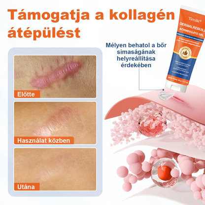 🔥Timilk® DermalRebuild bőrfiatalító gél