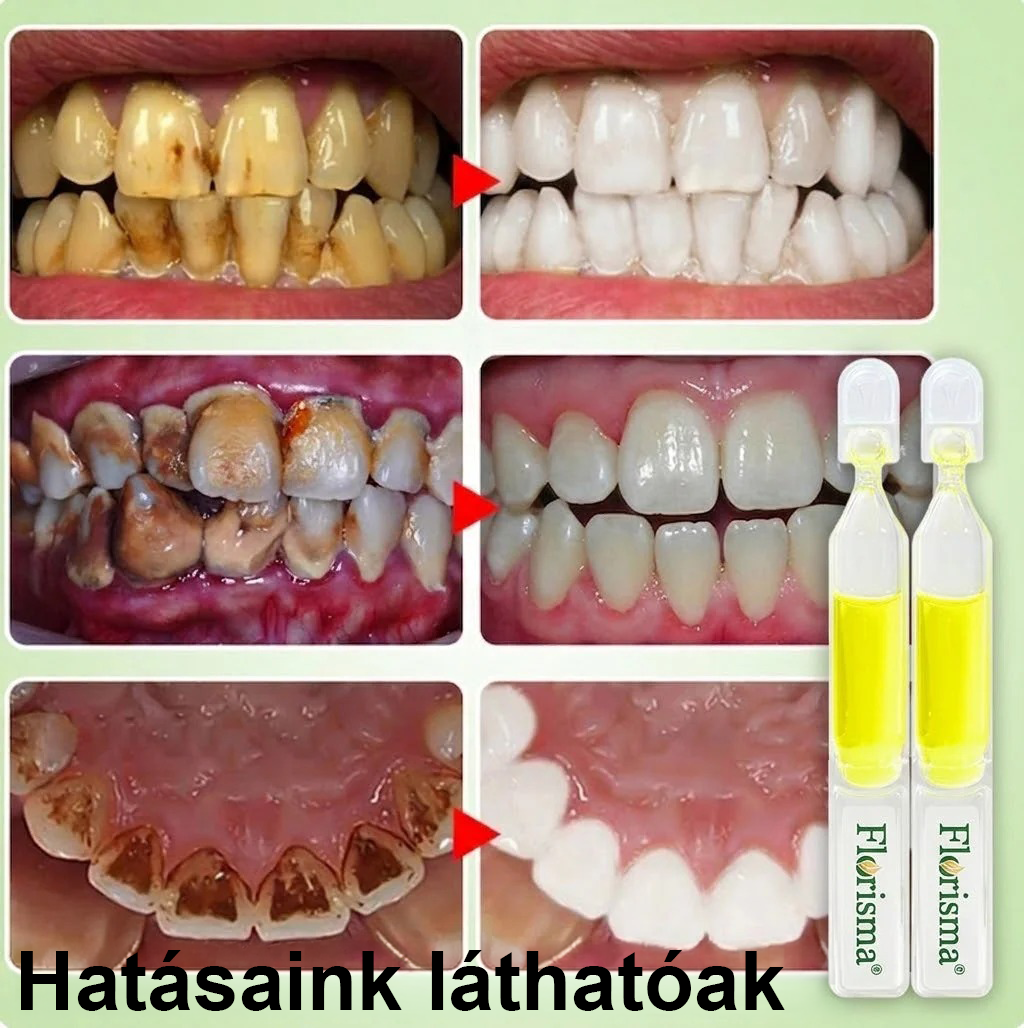 ✨FDA regisztrált & GMP tanúsítvánnyal｜𝓕𝒍𝒐𝒓𝓲𝘀𝒎𝗮® TRG zománcjavító ampullás fogkrém ✅Szuvasodás javítása｜Ínyápolás｜Friss lehelet｜Mélyfehérítés