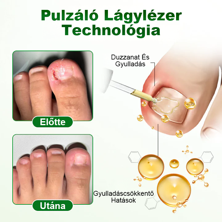 Pureluxo® HerbaNail 7 napos körömjavító szérum✨