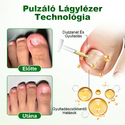 Pureluxo® HerbaNail 7 napos körömjavító szérum✨