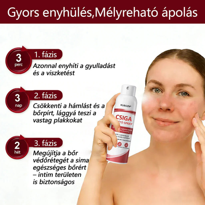 💡KUBOZN®  csigahéjas spray viszkető, hámló pikkelysömörös bőrre