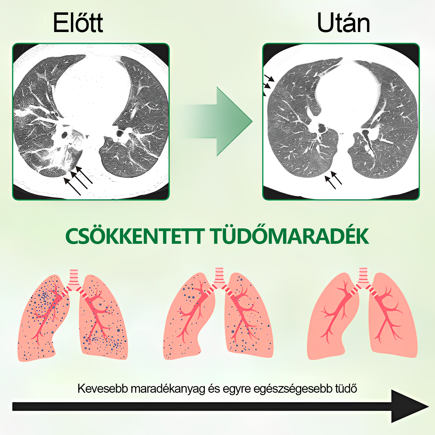 🌿𝐆𝐨𝐨𝐲𝐞𝐞𝐫™ Fejlett Tüdőtisztító Spray -Támogatja a tüdő, a hörgők és az orrmelléküregek egészségét, elősegíti a légzőrendszer egészségét és a könnyebb légzést