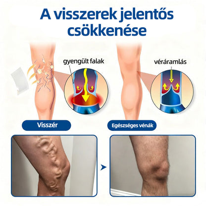 ✅Healrize® Vénacélpont mikrotűs tapasz⚡Azonnali enyhülés hosszú távú eredmények