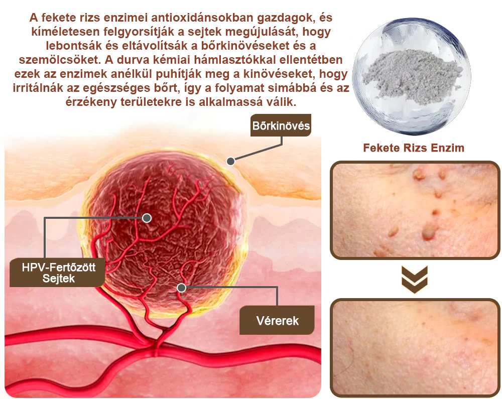 ✨ Pureluxo® Fekete Rizses Bőrregeneráló Krém 👨‍⚕️ (Szemölcsök, bőrkinövések, foltok és hiperpigmentáció kezelésére)