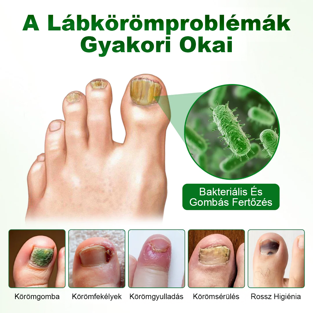 Pureluxo® HerbaNail 7 napos körömjavító szérum✨