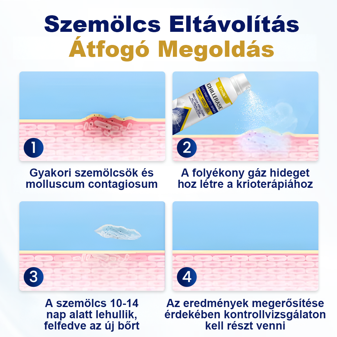 Timilk® ChillErase pattanásmegújító spray