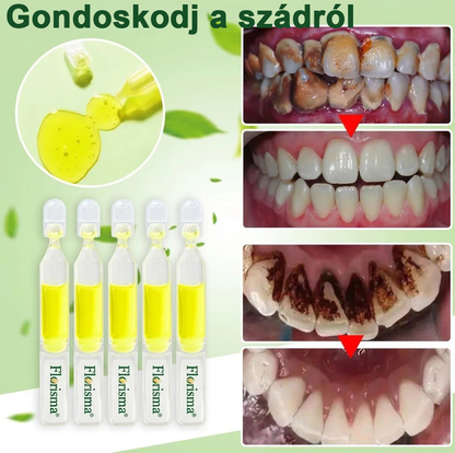 ✨FDA regisztrált & GMP tanúsítvánnyal｜𝓕𝒍𝒐𝒓𝓲𝘀𝒎𝗮® TRG zománcjavító ampullás fogkrém ✅Szuvasodás javítása｜Ínyápolás｜Friss lehelet｜Mélyfehérítés