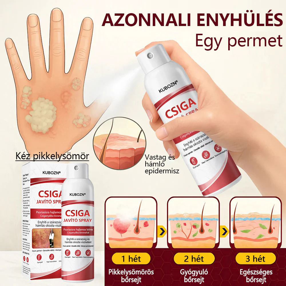 💡KUBOZN®  csigahéjas spray viszkető, hámló pikkelysömörös bőrre