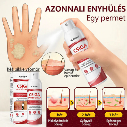💡KUBOZN®  csigahéjas spray viszkető, hámló pikkelysömörös bőrre