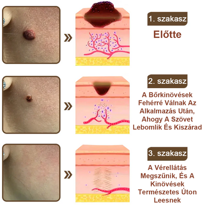 ✨ Pureluxo® Fekete Rizses Bőrregeneráló Krém 👨‍⚕️ (Szemölcsök, bőrkinövések, foltok és hiperpigmentáció kezelésére)