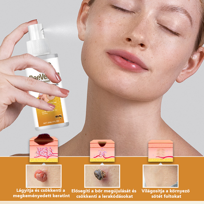 Pureluxo® BeeVenom Szemölcs Megújító Spray 🇭🇺