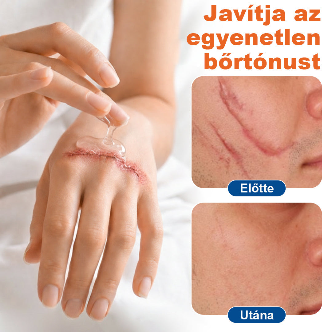 🔥Timilk® DermalRebuild bőrfiatalító gél