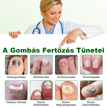 Pureluxo® HerbaNail 7 napos körömjavító szérum✨