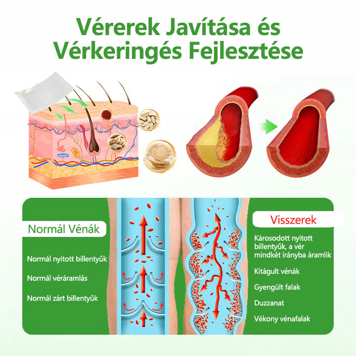 💡Laleia® VeinHeal mikrotűs tapasz