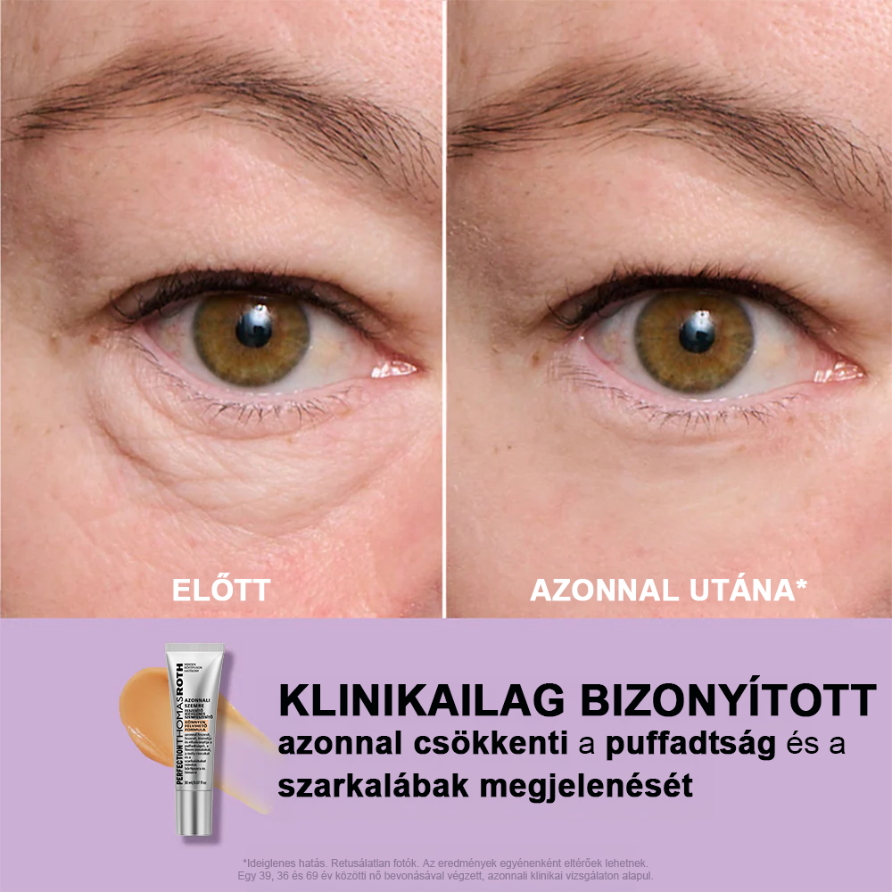 🌸Azonnali Szemkörnyék-Feszesítő Könnyű Formula – Végső Emelés és Sima Befejezés ✨✨