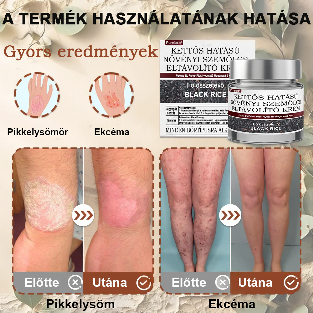 ✨ Pureluxo® Fekete Rizses Bőrregeneráló Krém 👨‍⚕️ (Szemölcsök, bőrkinövések, foltok és hiperpigmentáció kezelésére)