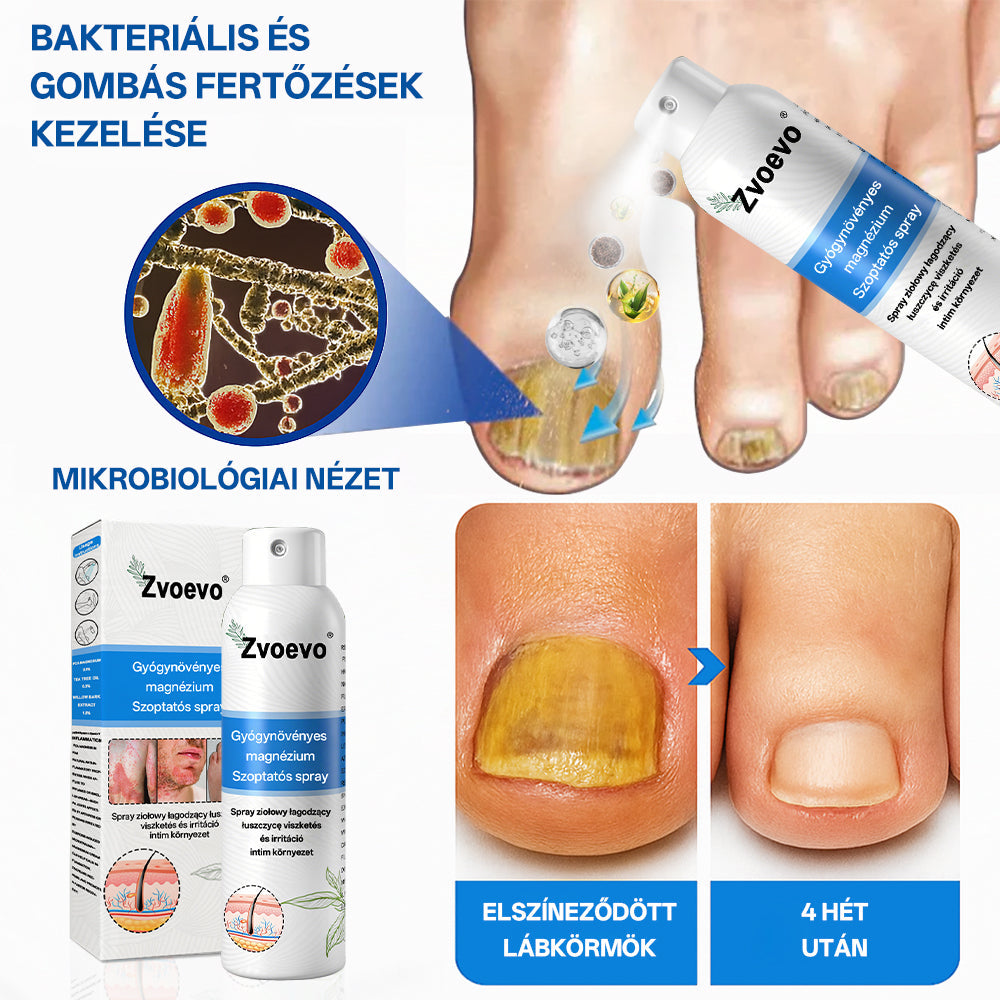 ✅ Hivatalos bolt: Zvoevo® Magnéziumos gyógynövényes spray pikkelysömörre ⚕️ MHRA tanúsítvánnyal (enyhíti a pikkelysömört, ekcémát, kezeli pattanásokat, szemölcsöket, javítja bakteriális fertőzéseket)