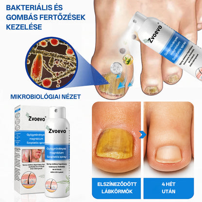 ✅ Hivatalos bolt: Zvoevo® Magnéziumos gyógynövényes spray pikkelysömörre ⚕️ MHRA tanúsítvánnyal (enyhíti a pikkelysömört, ekcémát, kezeli pattanásokat, szemölcsöket, javítja bakteriális fertőzéseket)