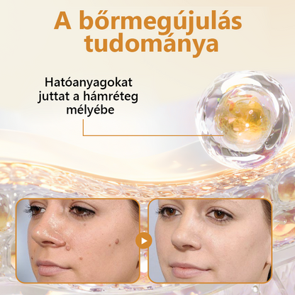 Pureluxo® BeeVenom Szemölcs Megújító Spray 🇭🇺