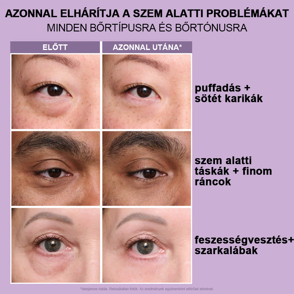 🌸Azonnali Szemkörnyék-Feszesítő Könnyű Formula – Végső Emelés és Sima Befejezés ✨✨