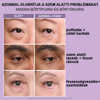🌸Azonnali Szemkörnyék-Feszesítő Könnyű Formula – Végső Emelés és Sima Befejezés ✨✨