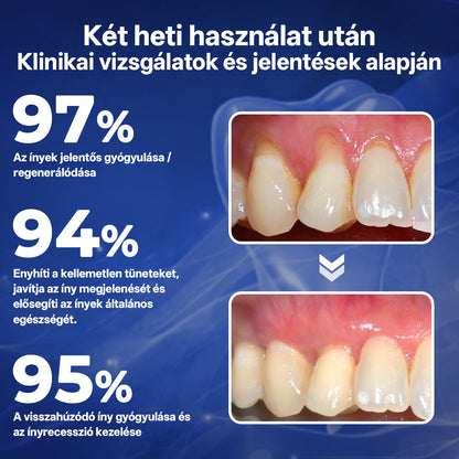✅Rolimey® BeeTakt Méhméreg Fogápoló Cseppek Szájvíz-📦