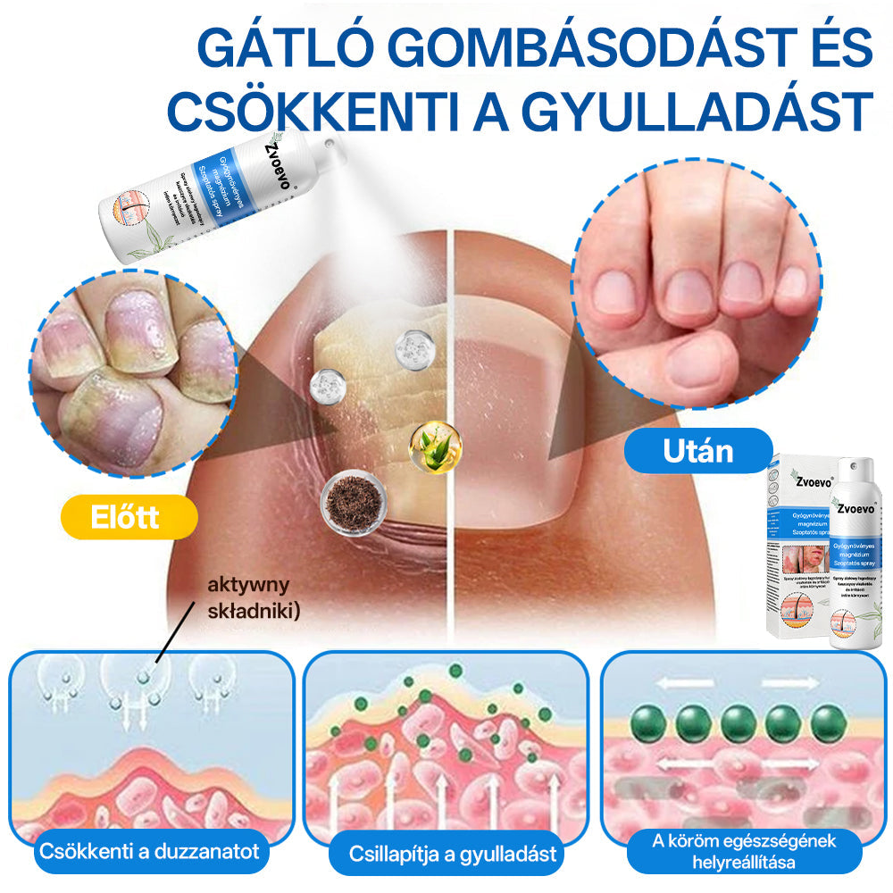 ✅ Hivatalos bolt: Zvoevo® Magnéziumos gyógynövényes spray pikkelysömörre ⚕️ MHRA tanúsítvánnyal (enyhíti a pikkelysömört, ekcémát, kezeli pattanásokat, szemölcsöket, javítja bakteriális fertőzéseket)