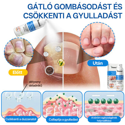 ✅ Hivatalos bolt: Zvoevo® Magnéziumos gyógynövényes spray pikkelysömörre ⚕️ MHRA tanúsítvánnyal (enyhíti a pikkelysömört, ekcémát, kezeli pattanásokat, szemölcsöket, javítja bakteriális fertőzéseket)
