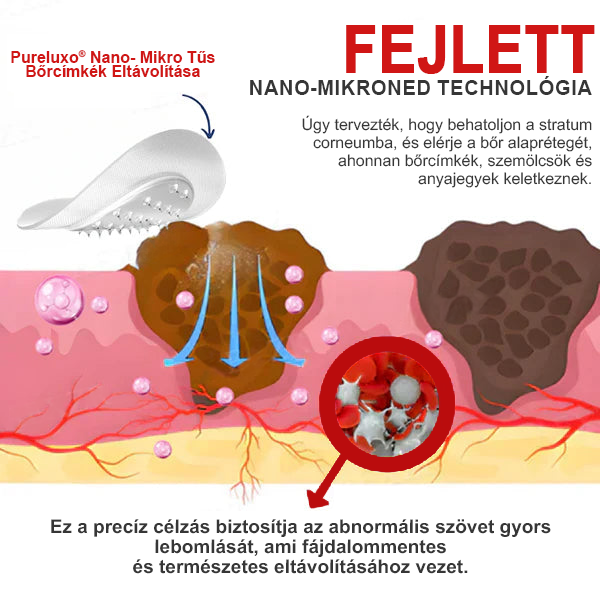 Pureluxo® Nano-mikrotűs bőrcímke-eltávolító tapaszok ✨