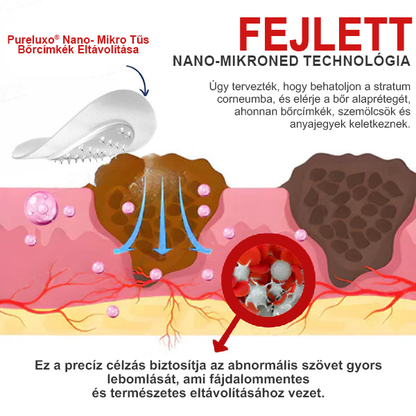 Pureluxo® Nano-mikrotűs bőrcímke-eltávolító tapaszok ✨