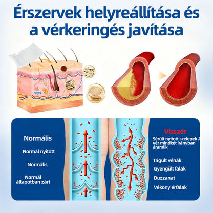 ✅Healrize® Vénacélpont mikrotűs tapasz⚡Azonnali enyhülés hosszú távú eredmények